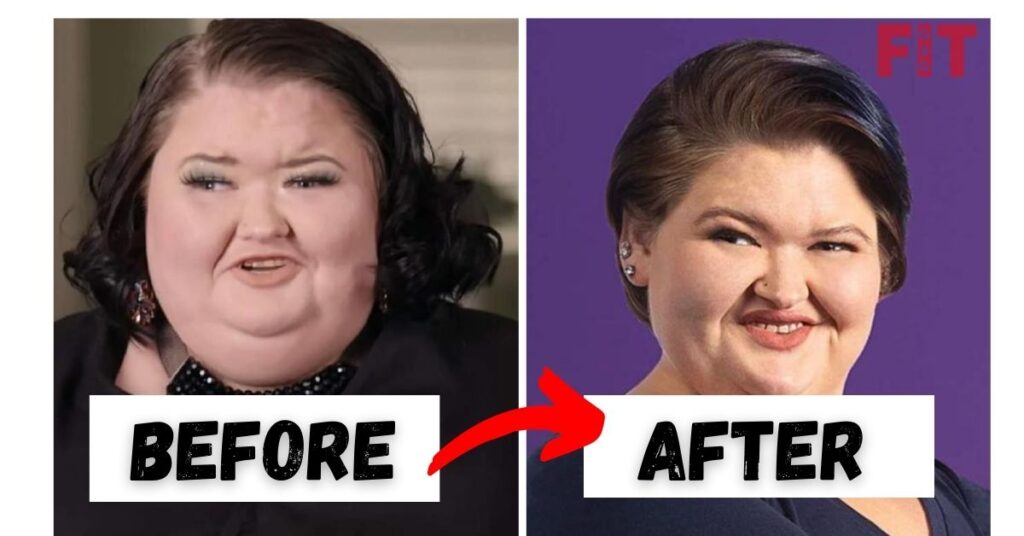 Amy Slaton Weight Loss 2022 Before And After