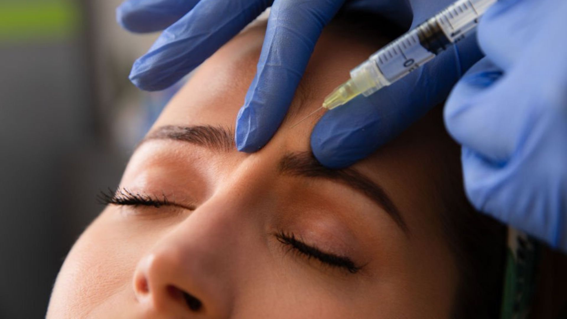 Botox Brow Lift All You Need To Know With Before And After Photos