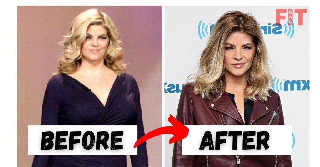 Kirstie Alley 2022 Weight Loss Before And After