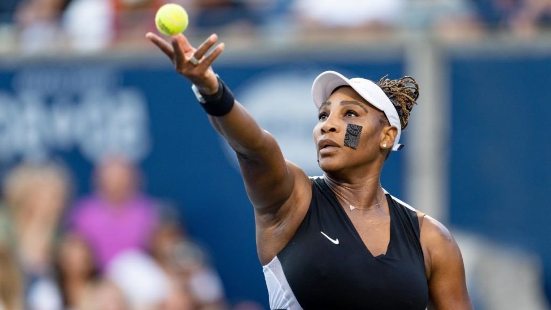 Serena Williams' Plastic Surgery