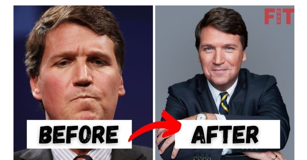 Tucker Carlson Weight Loss 2022 Before And After