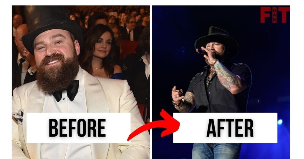 Zac Brown 2022 Weight Loss Before And After
